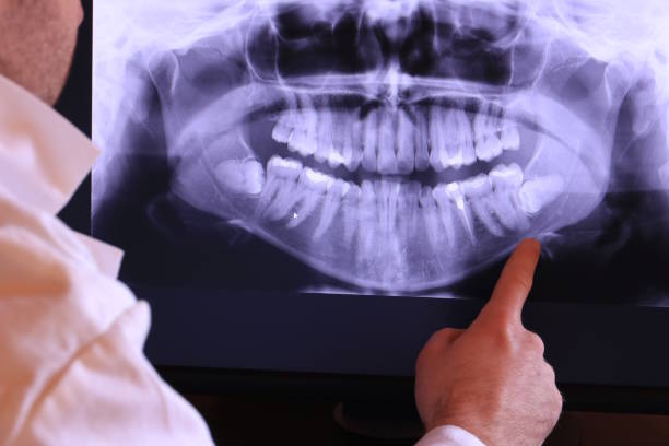 Best Tooth Pain Emergency Relief  in Griffith, IN