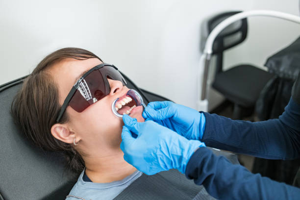 Emergency Dental Filling Replacement in IN