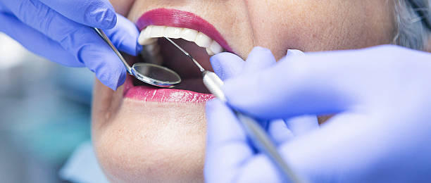 Best Knocked-Out Tooth Emergency  in Griffith, IN
