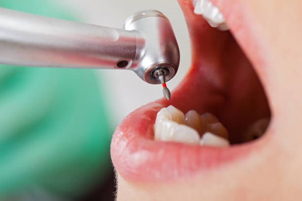 Best Tooth Infection Emergency Dentist  in Griffith, IN
